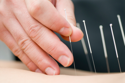 Dry Needling Brisbane