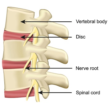 Back Pain Brisbane