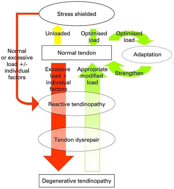 Tendinopathy